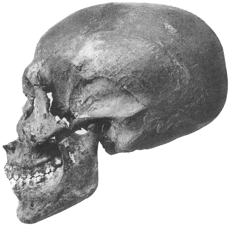 Skull from KV 55 believed to be Akhenaton, Valley of the Kings