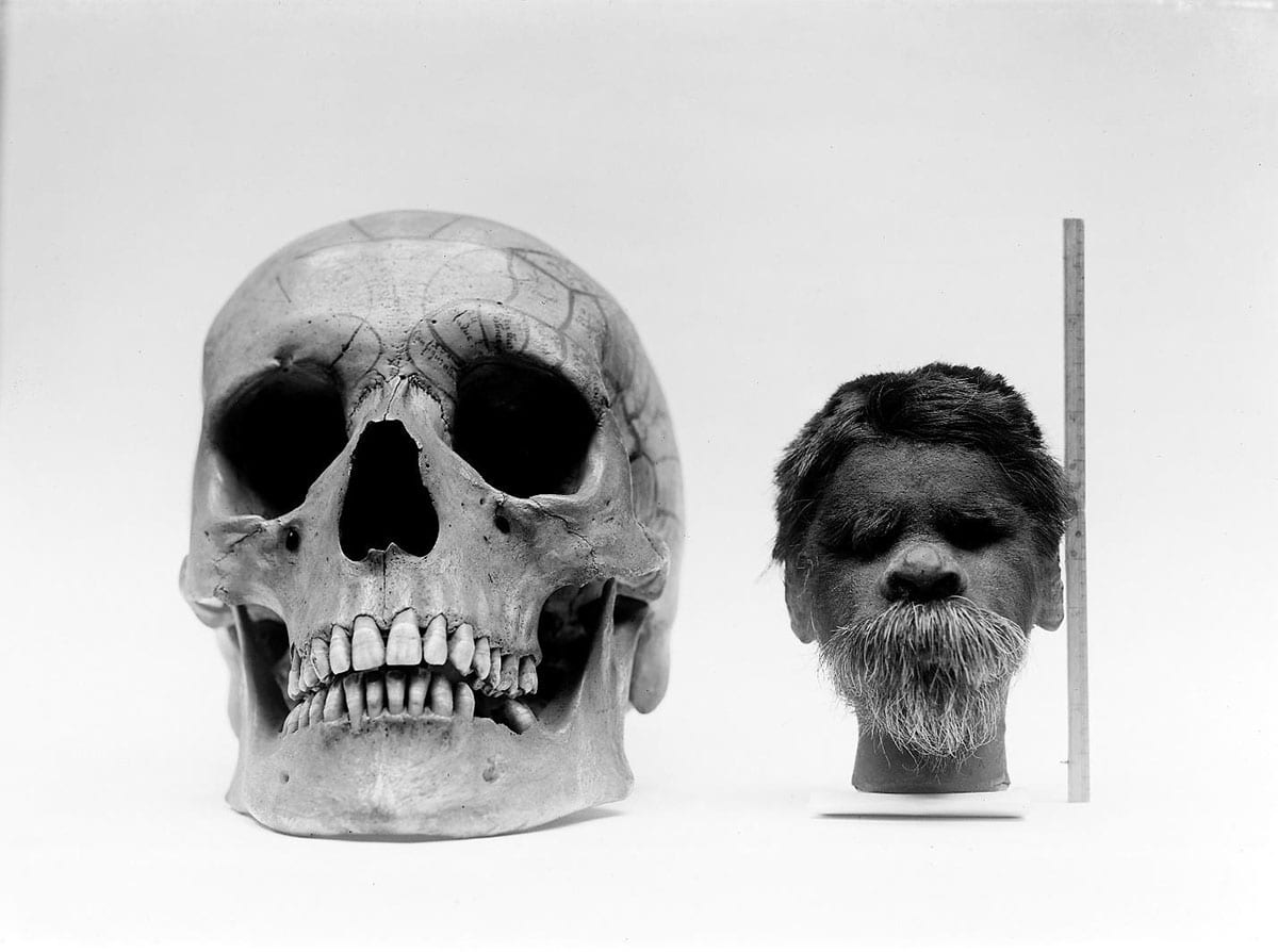 Shrunken head compared with normal human skull, via Wellcome Museum