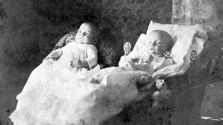 An image showing twins, where one is dead and the other alive. 