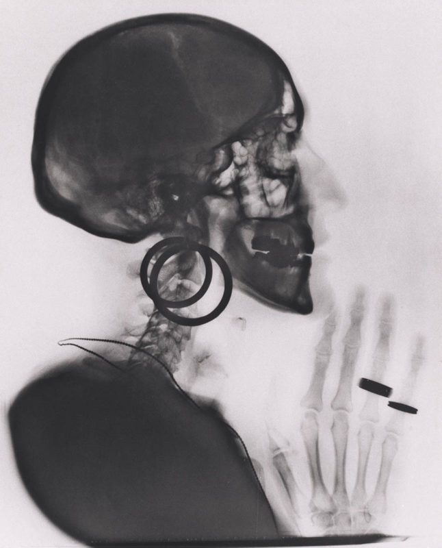 meret oppenheim x ray