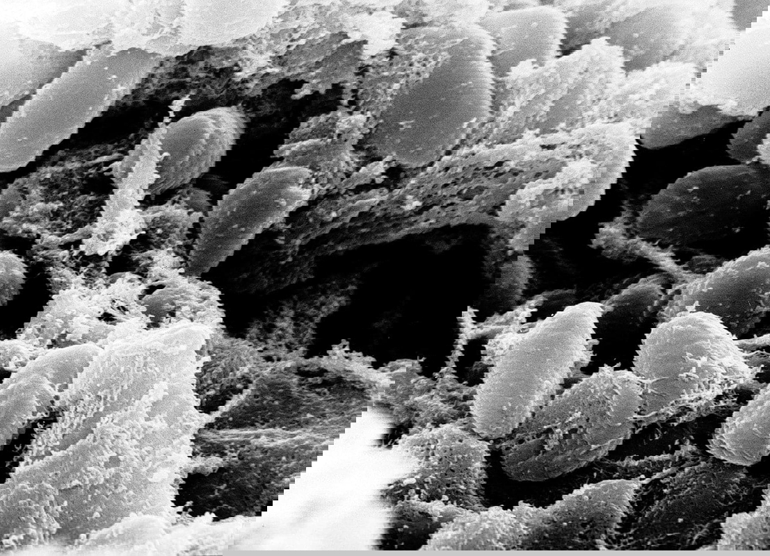 yersinia pestis bacteria photograph electron miscroscope