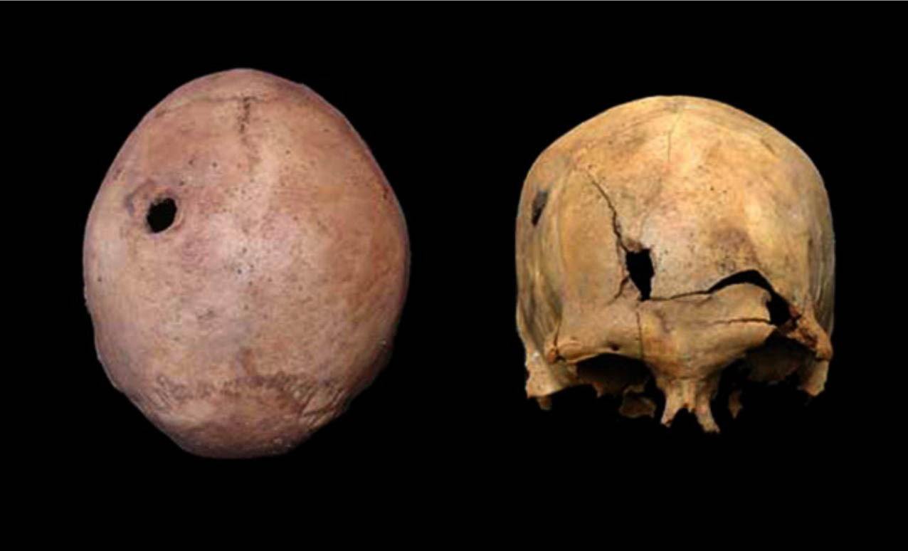 incan bones