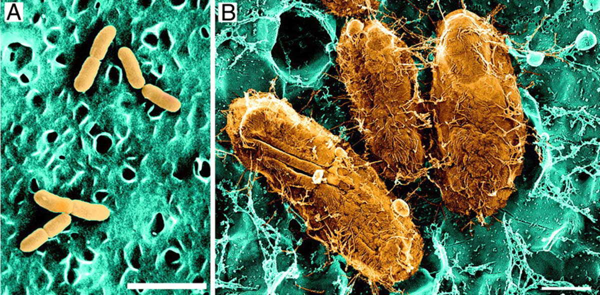 e coli viewed with electron microscope in bladder