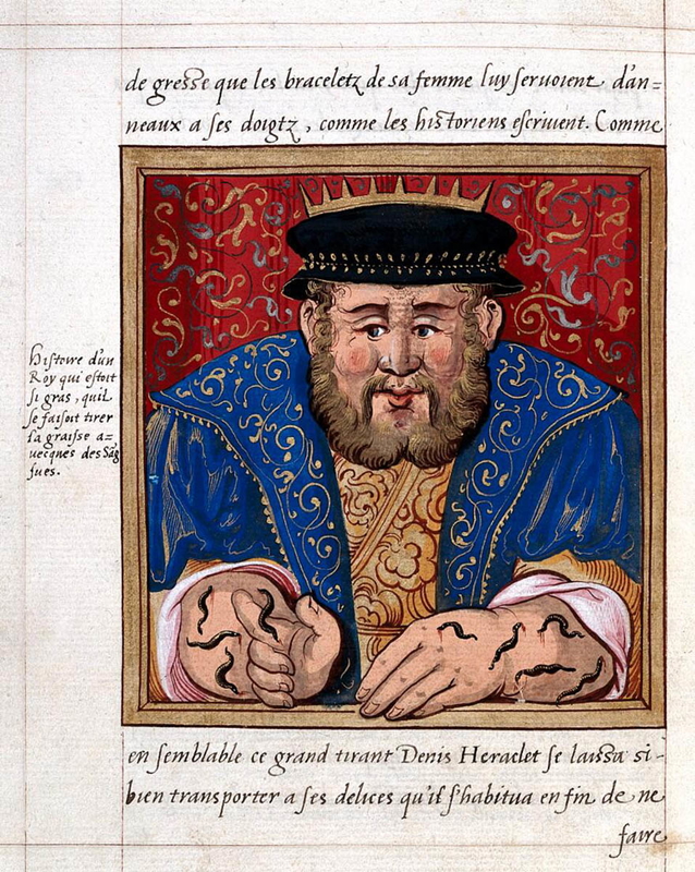 leeches illustration pierre boaistuau black death