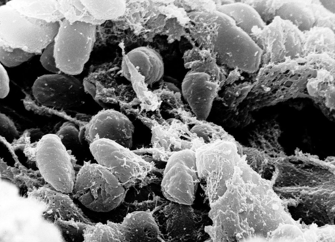 yersinia pestis microscope photograph