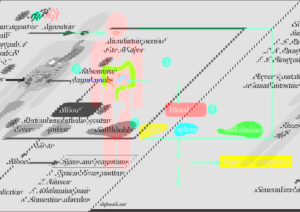 Salmonella paratyphi pathogenesis disease progression typhoid