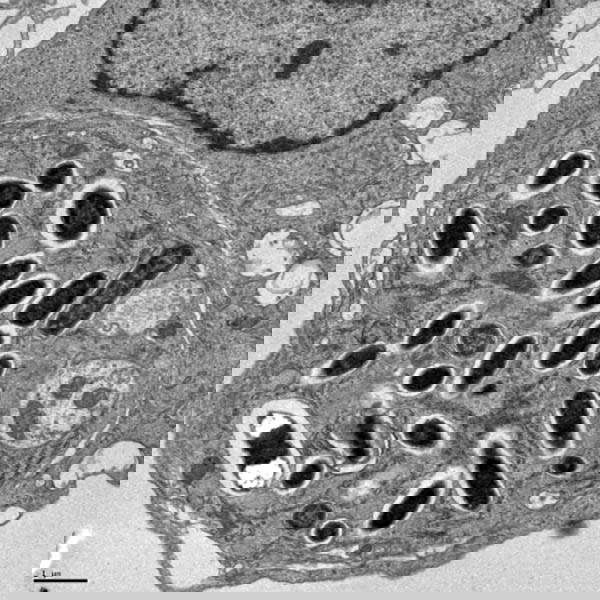 salmonella outbreak replicating inside macrophage