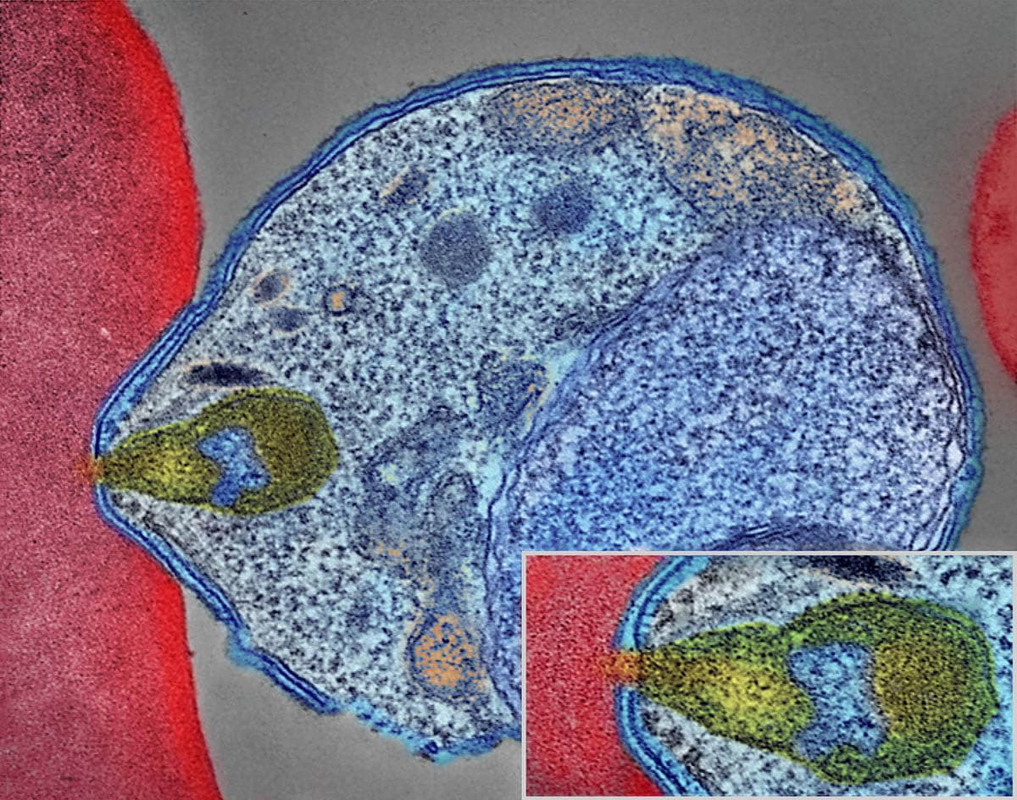 malaria parasite human blood cell image