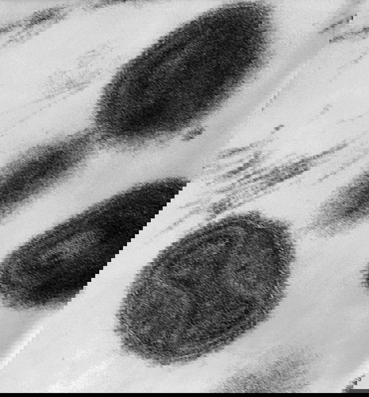 Smallpox virus transmission electron micrograph