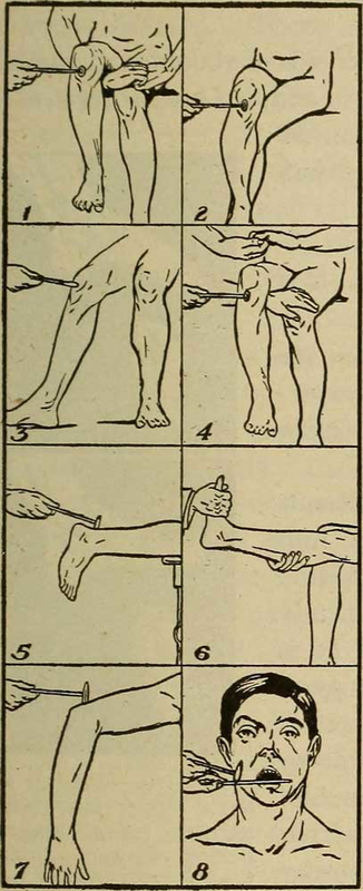 affect diagnosis reflex