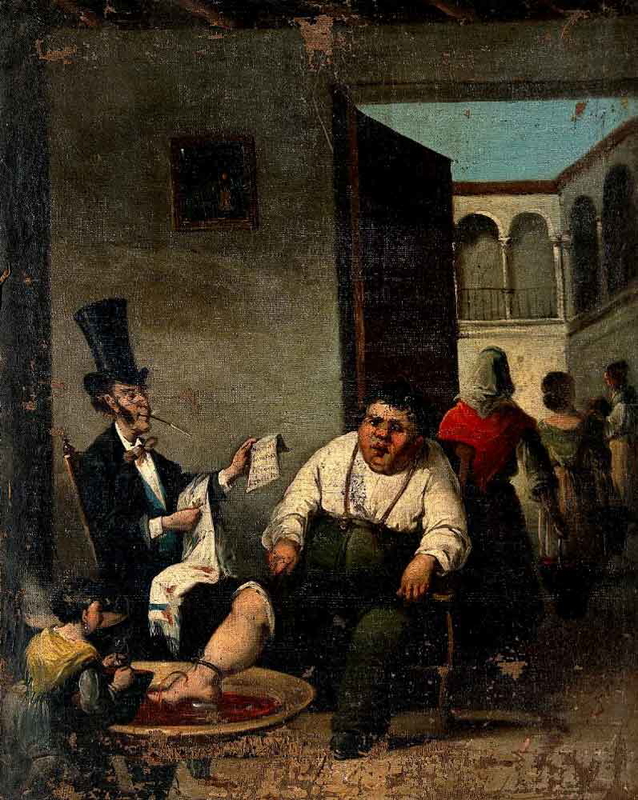 daumier bloodletting from foot