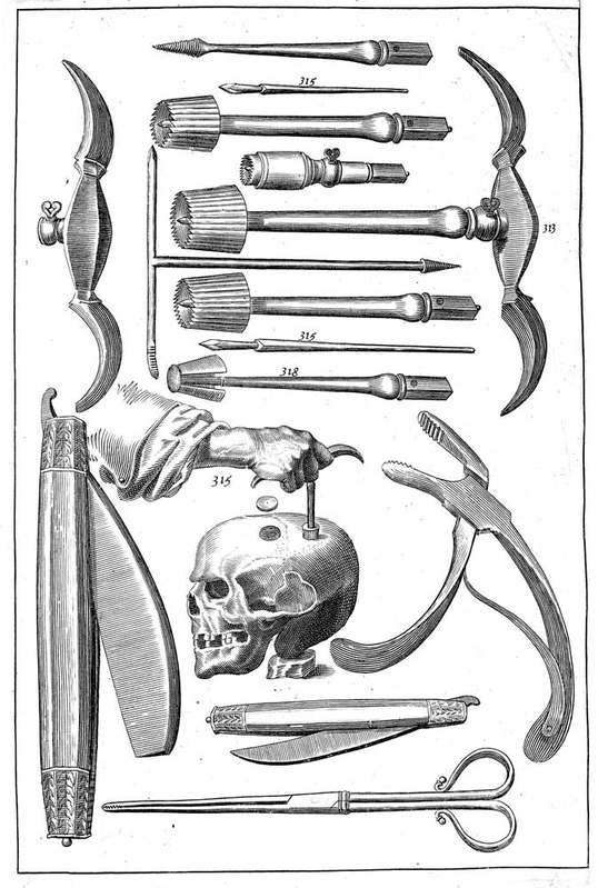 woodall john surgeon mate trapanation instruments print