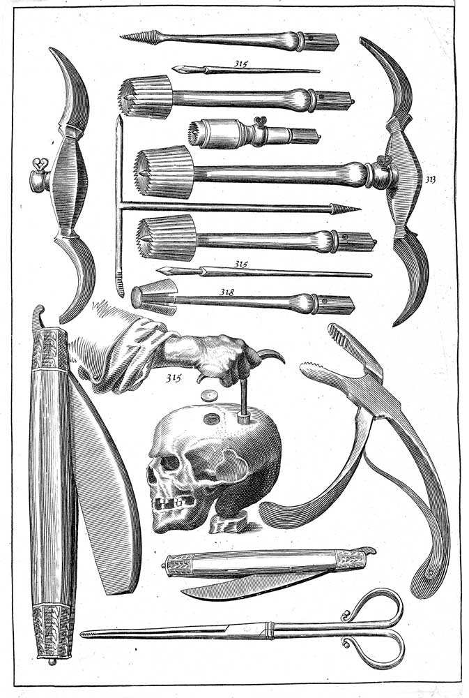 woodall john surgeon mate trapanation instruments print