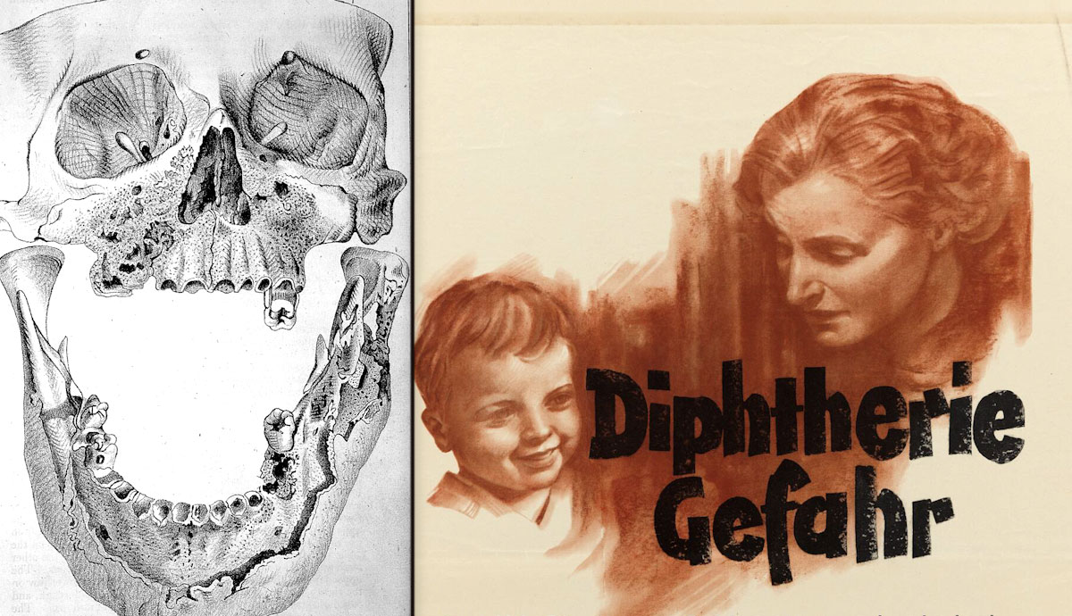 history of diseases that no longer exist