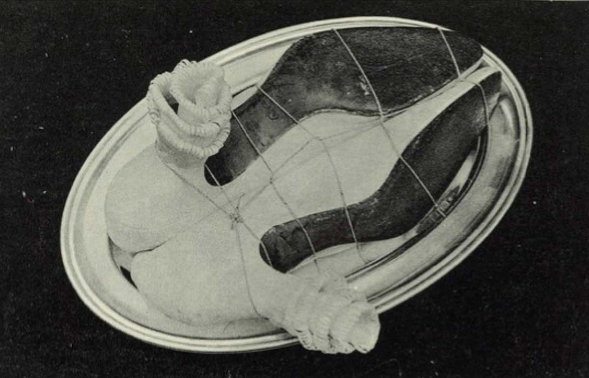 meret oppenheim my nurse