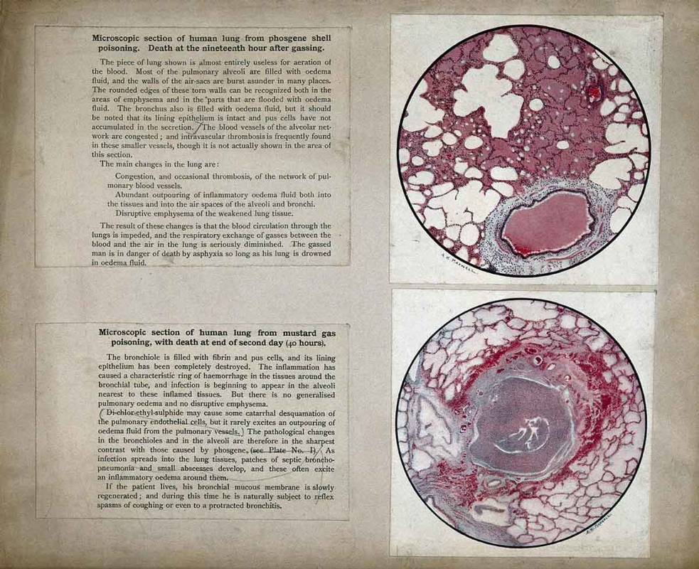 effects mustard gas