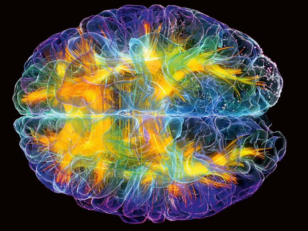 brain activity