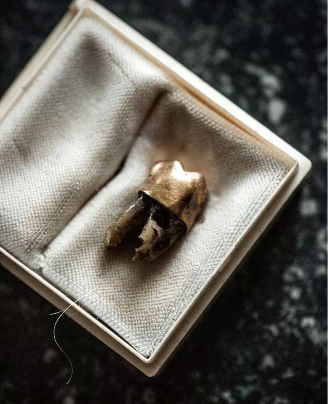 patrice lumumba tooth