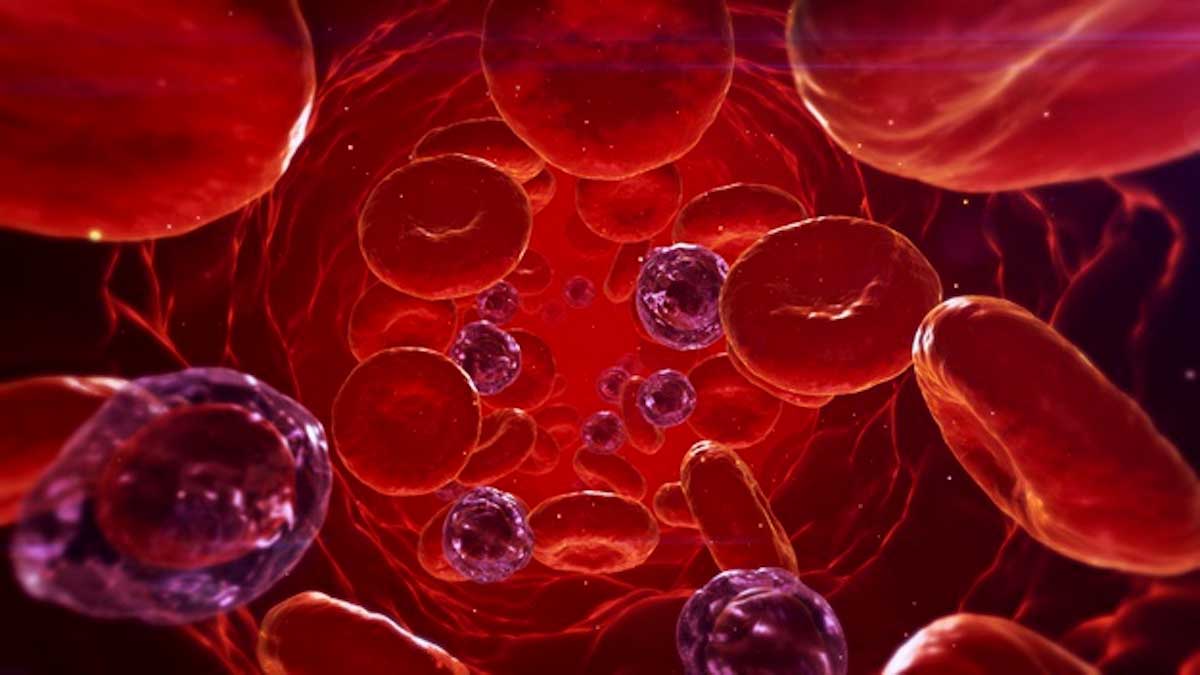 methemoglobinemia image cells