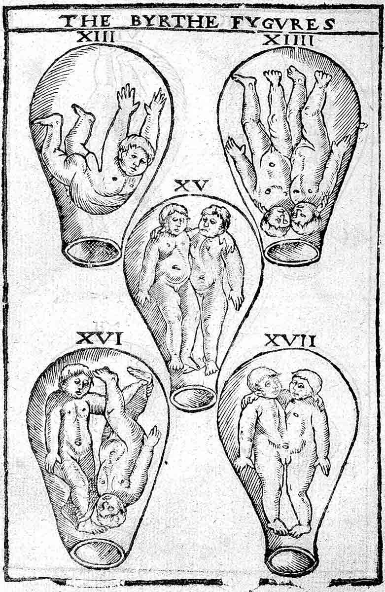eucharius rösslin the birth of mankinde