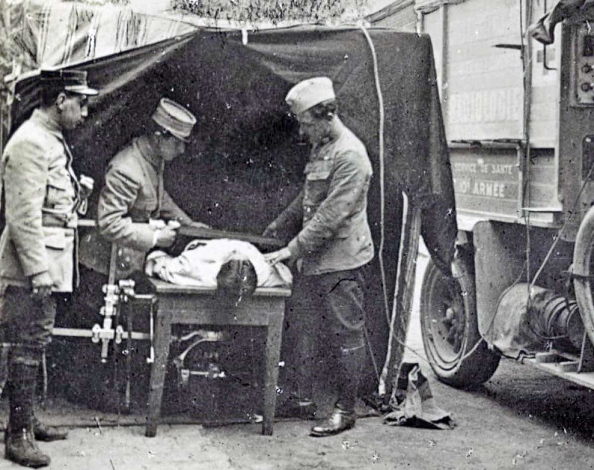world war i mobile x ray