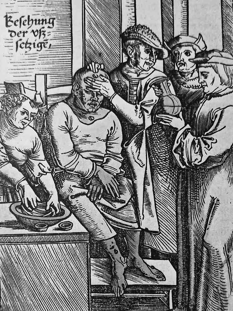 lepers diagnosis 16th century