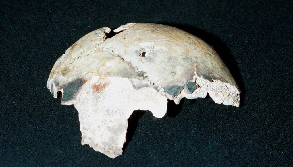 adolf hitler skull