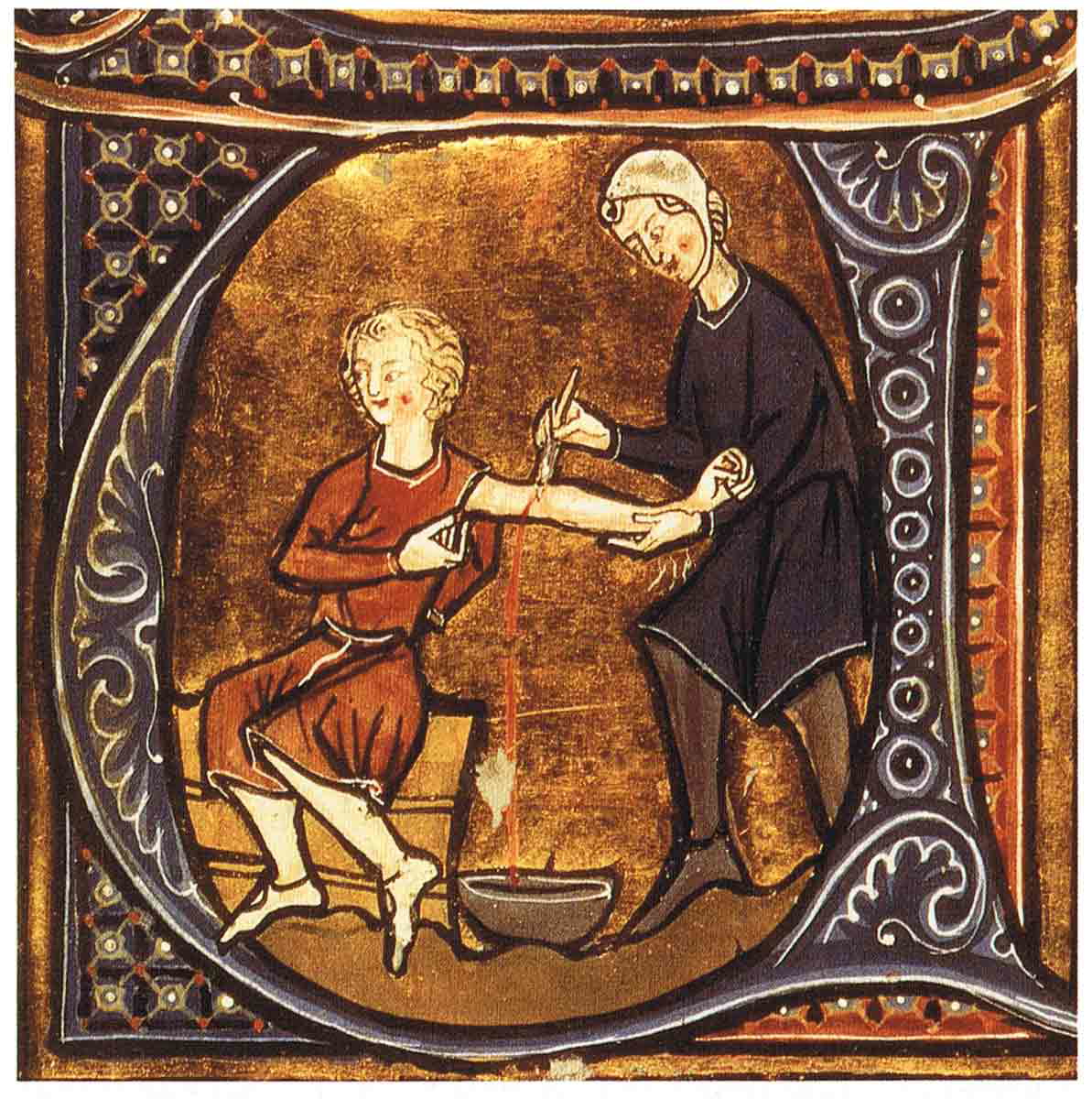 history of disease bloodletting