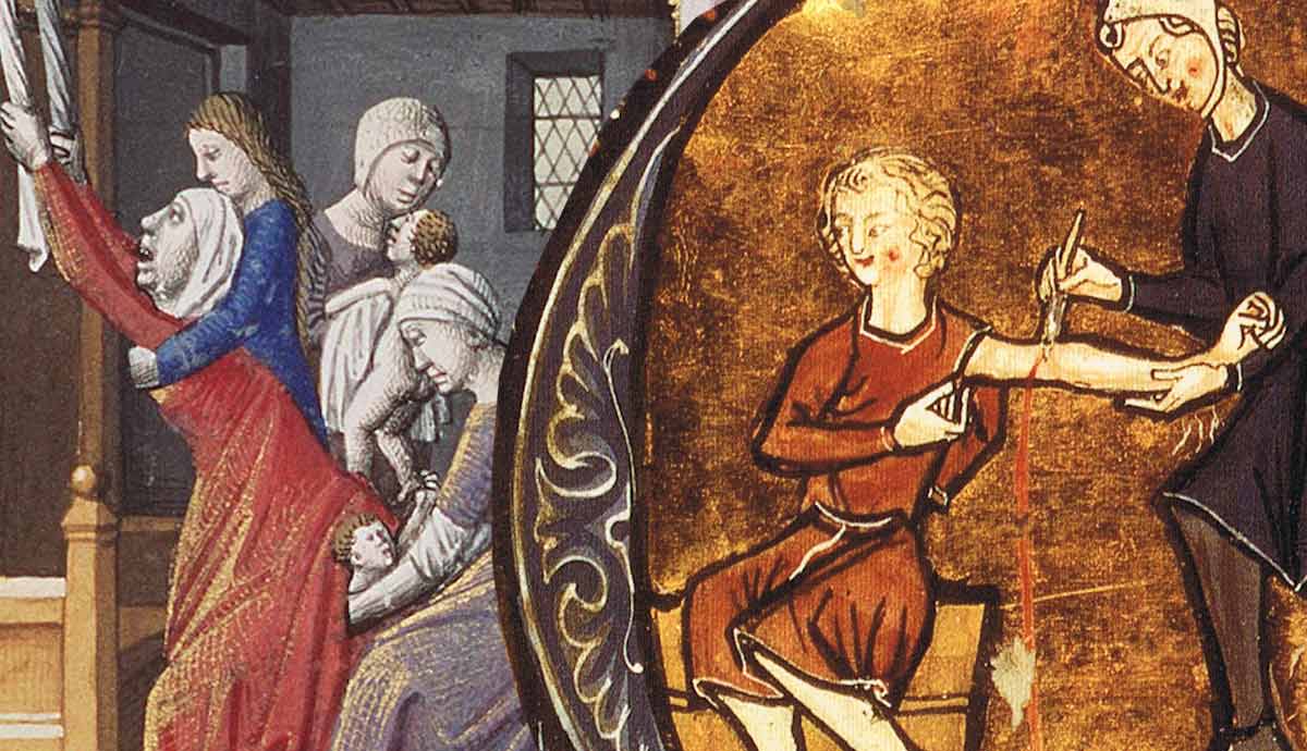 history of disease goofs