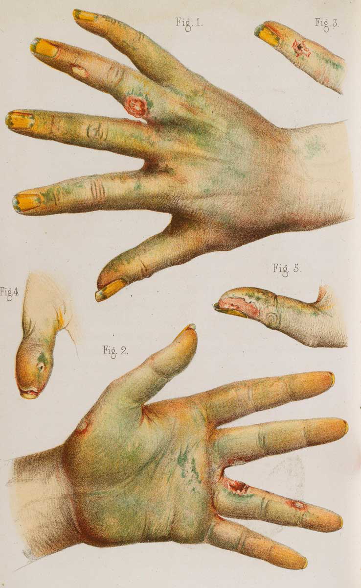 19th century drawing of hands