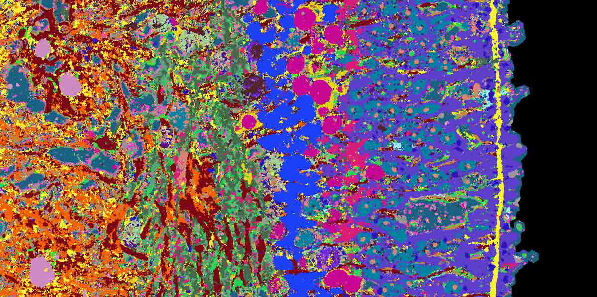 human retina photograph