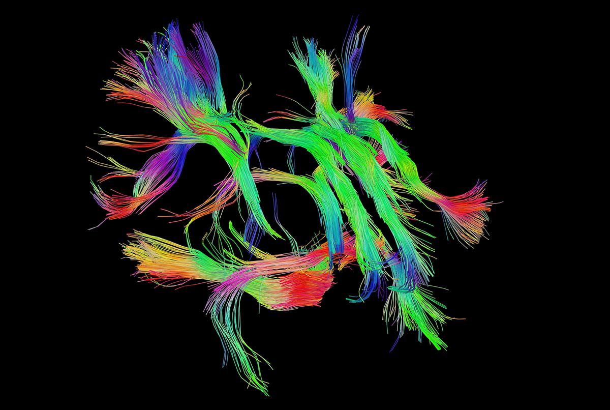 vibrant brain scan