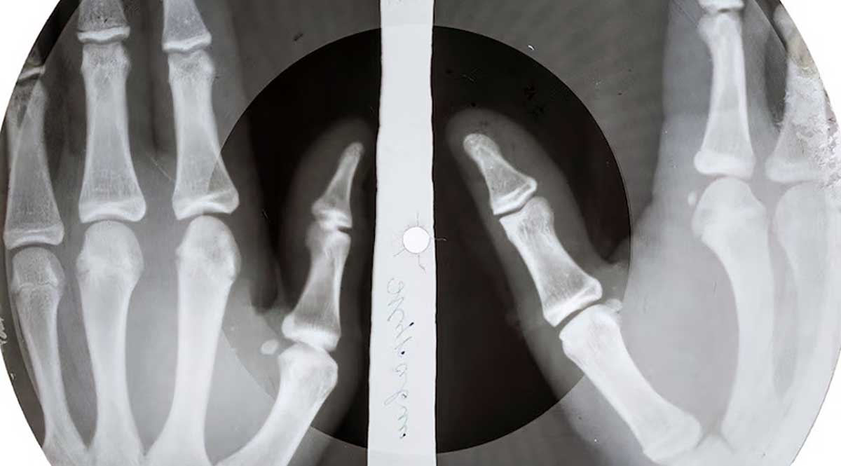 jazz diplomacy cold war x ray