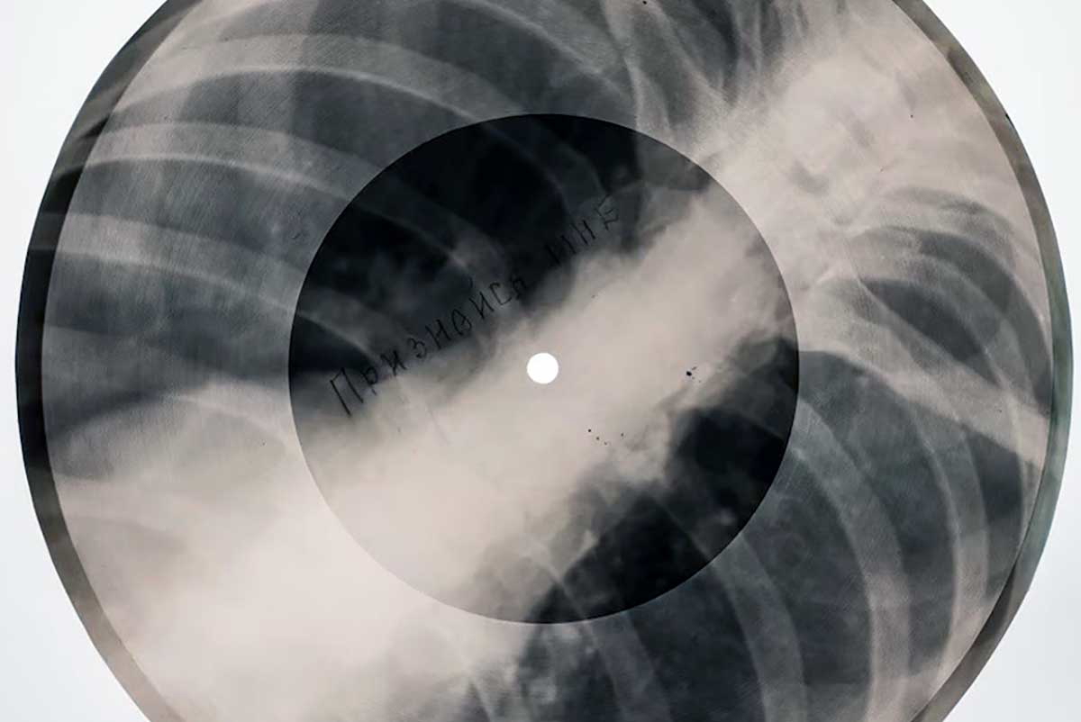 jazz diplomacy x ray