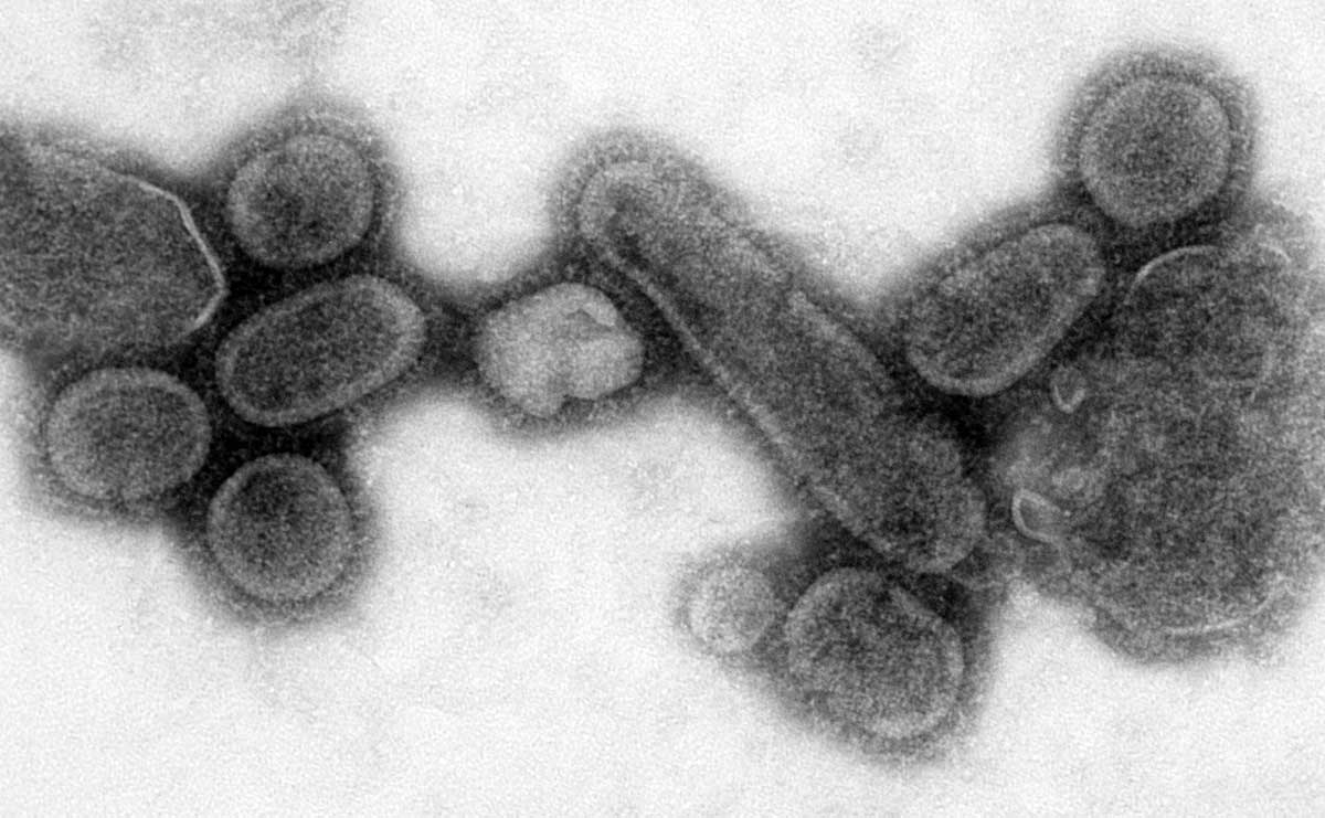 spanish influenza virus recreation 1918 flu micrograph