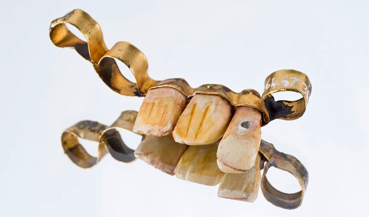 roman medicine dental bridge