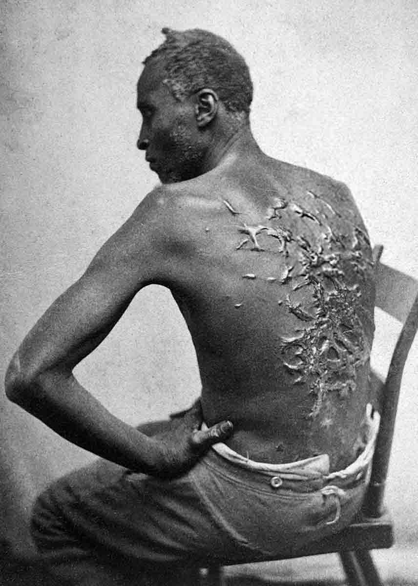 gordon slave with scorged back