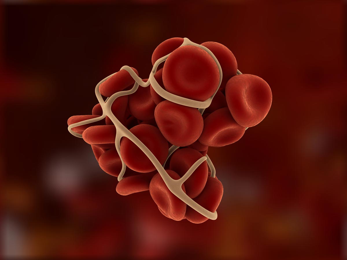 alix hesse blood clot