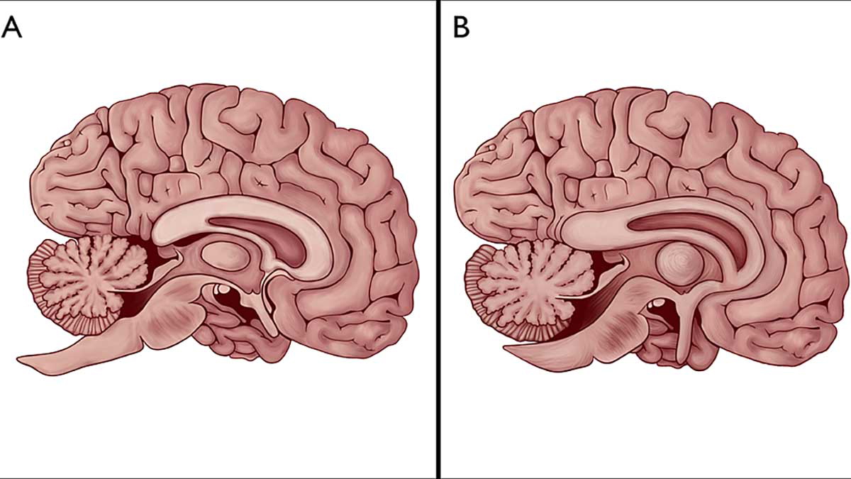 Brain diagram