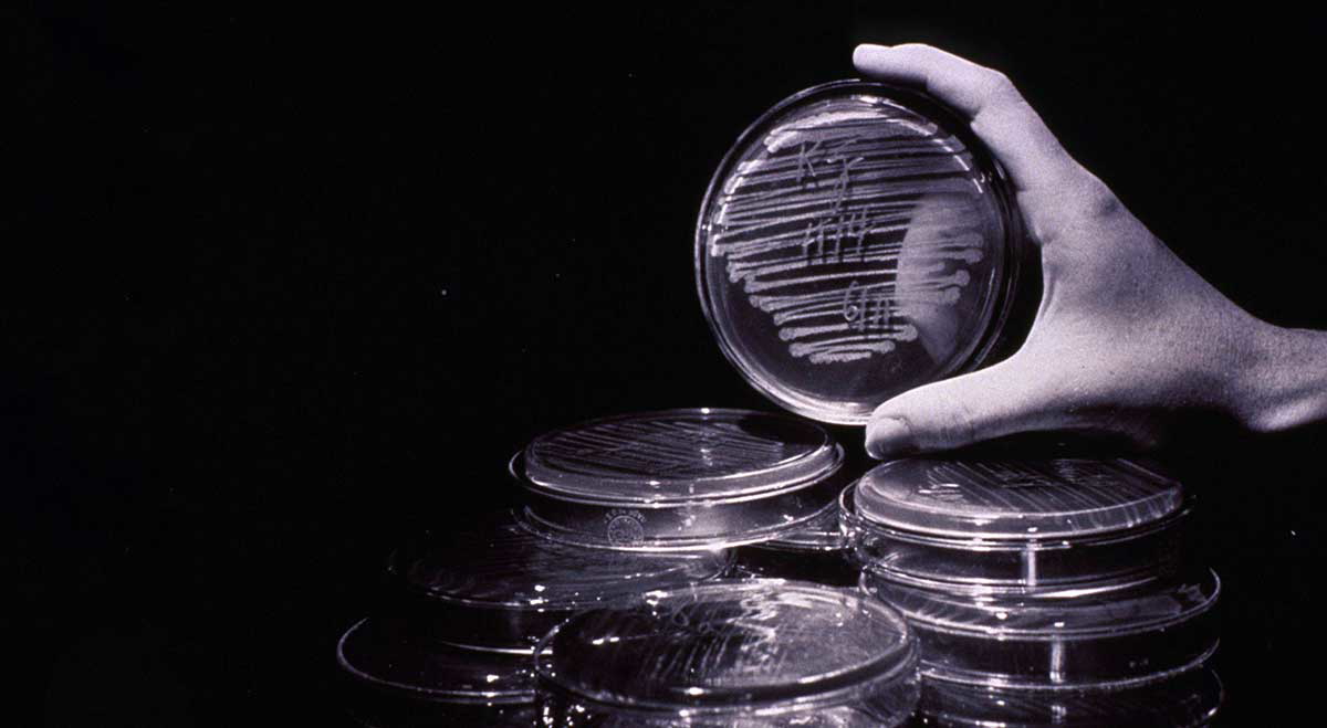 cold virus research petri dish