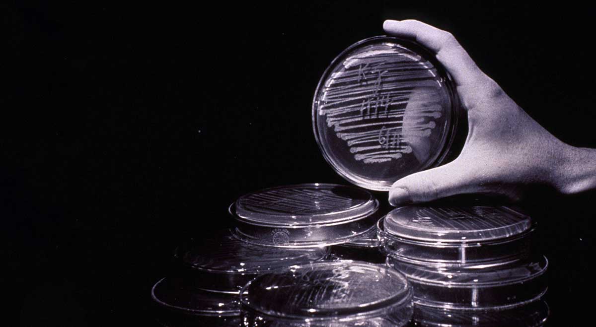 cold virus research petri dish