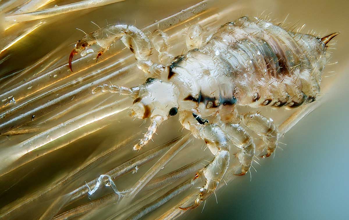 human head louse