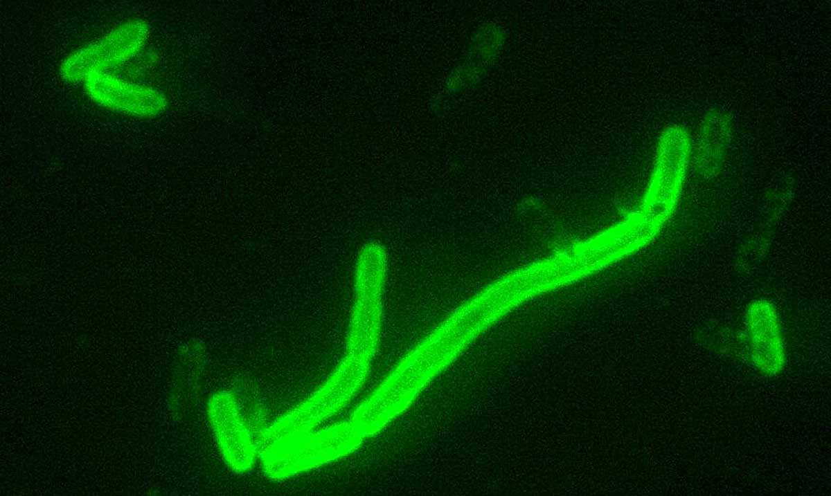yersinia pestis plague