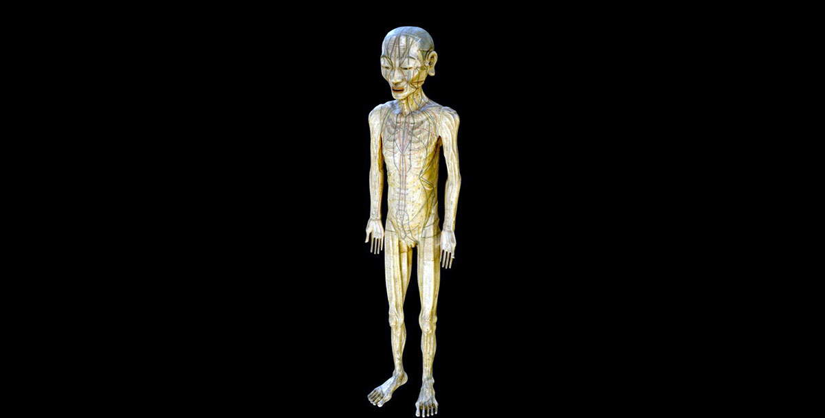 japan acupuncture sculpture