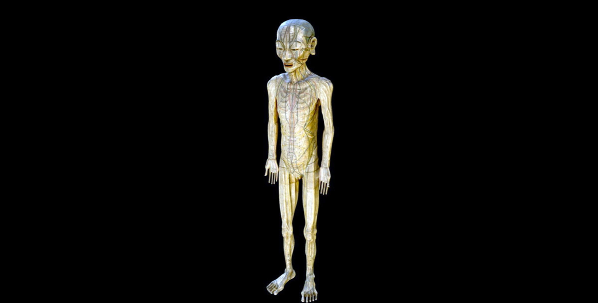 japan acupuncture sculpture