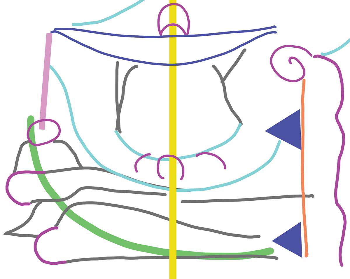 wallwork blake house death diagram