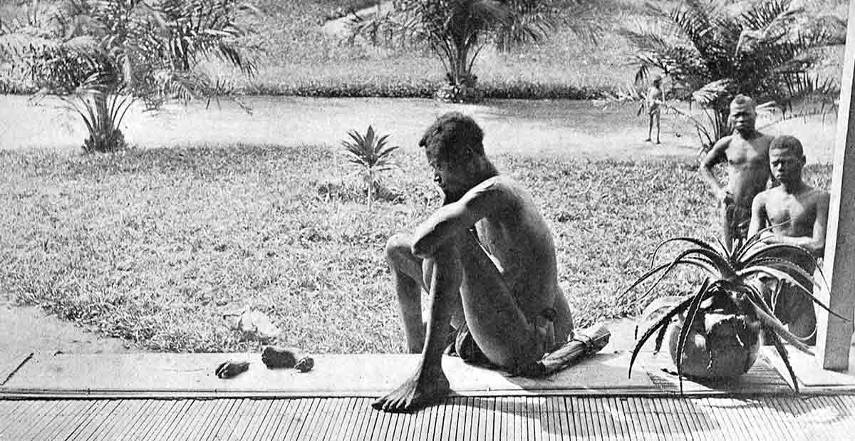 man severed limbs child