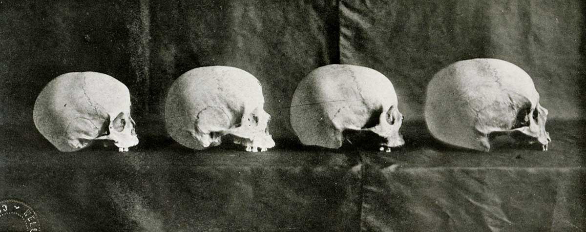 phrenology study for eugenics