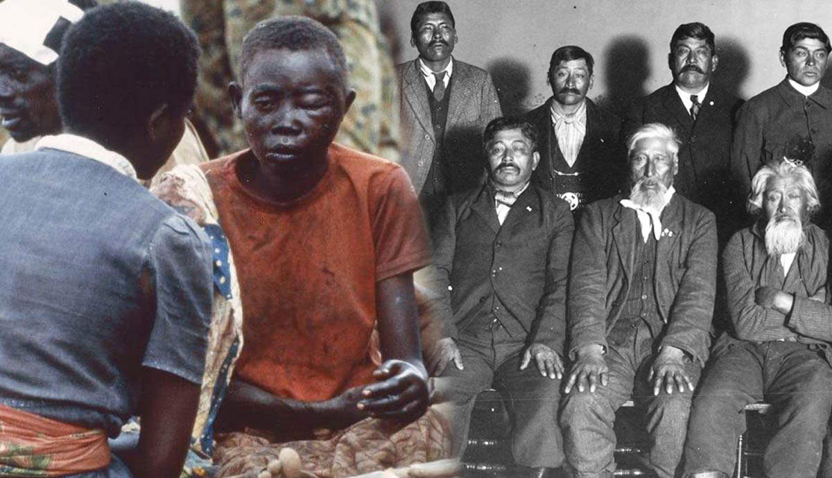 The Devastating Legacy of Settler Colonialism on Former Colonies