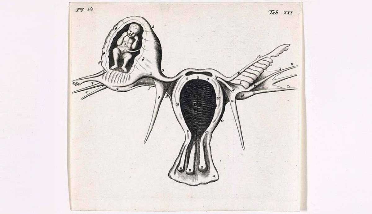 ectopic pregnancy diagram